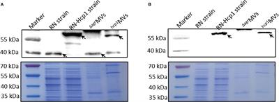 Hcp1-loaded staphylococcal membrane vesicle vaccine protects against acute melioidosis